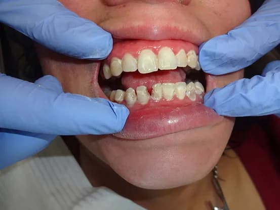 Case 7 Image 3