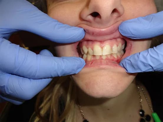 Case 1 Image 3