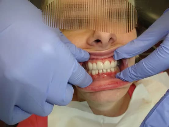 Case 1 Image 4