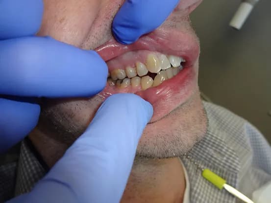 Case 9 Image 5