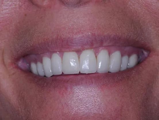 Case 5 Image 6