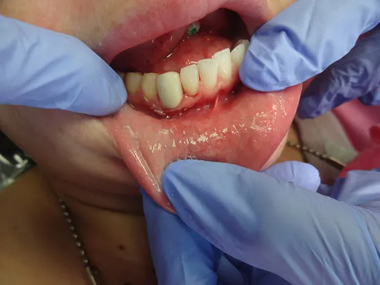 Case 10 Image 2