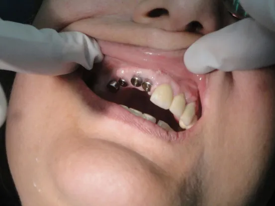 Case 4 Image 2