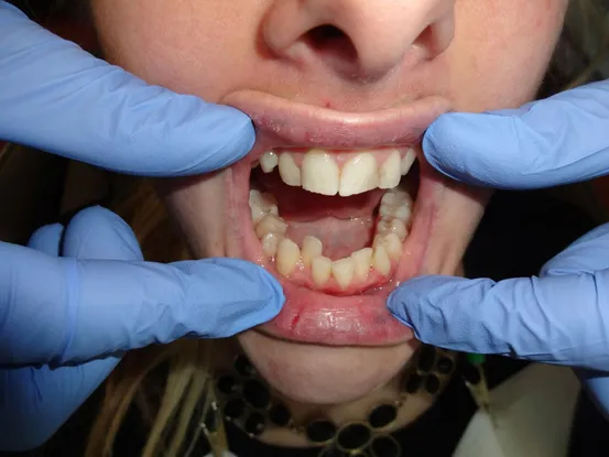 Case 1 Image 2