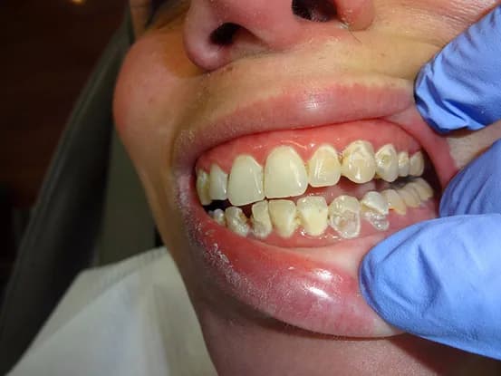 Case 7 Image 2