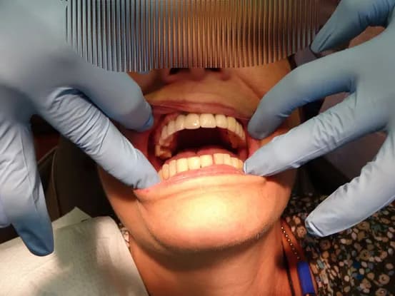 Case 4 Image 3