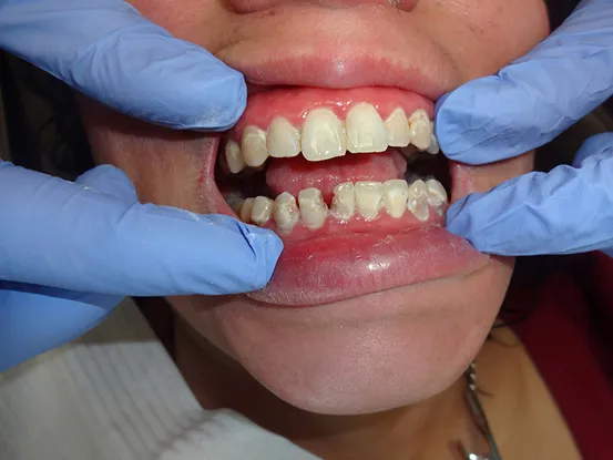 Case 7 Image 3