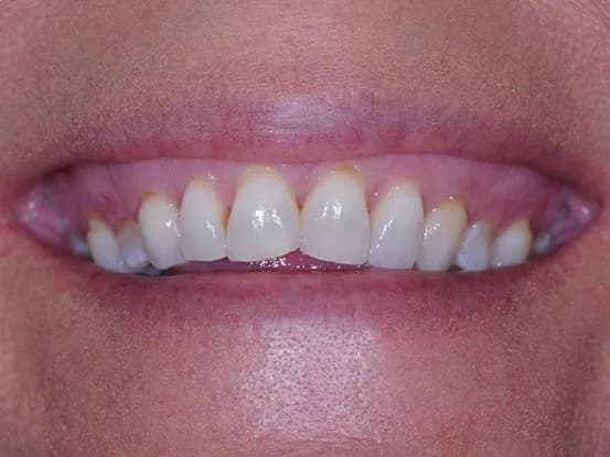 Case 5 Image 4