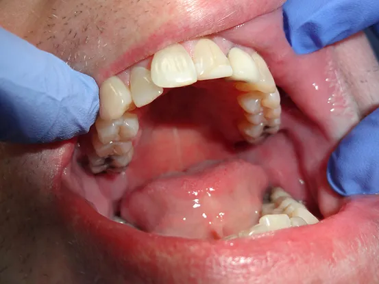 Case 9 Image 4