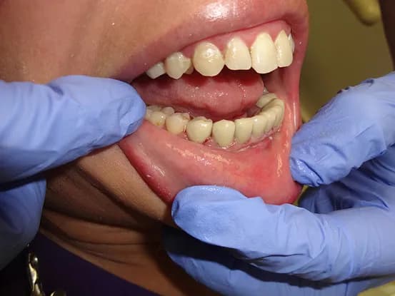 Case 7 Image 6