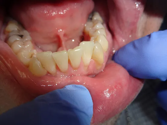 Case 9 Image 6
