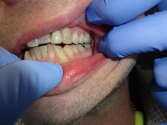 Case 9 Image 7