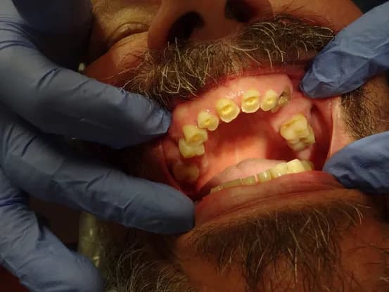 Case 2 Image 1