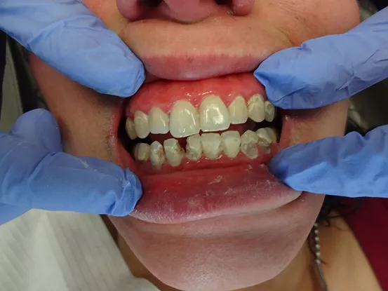 Case 7 Image 1