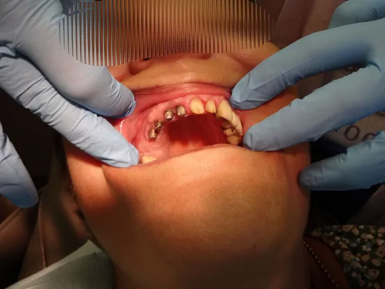 Case 4 Image 1