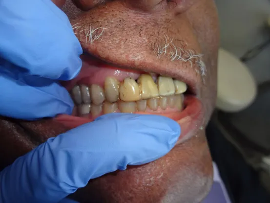 Case 6 Image 2
