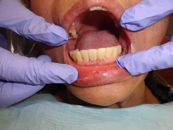 Case 8 Image 2