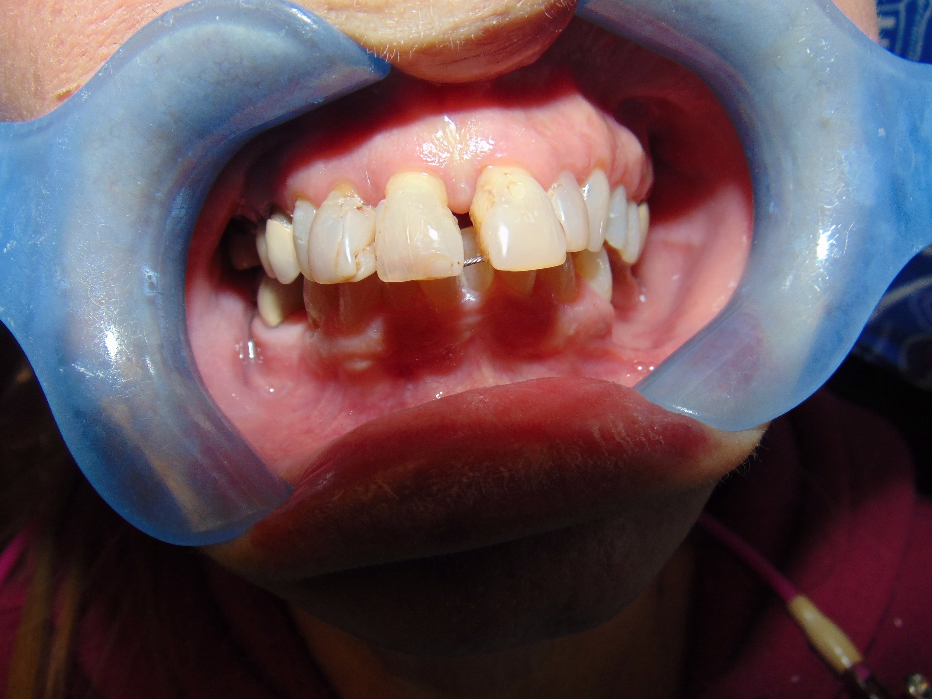 Case 12 Image 2