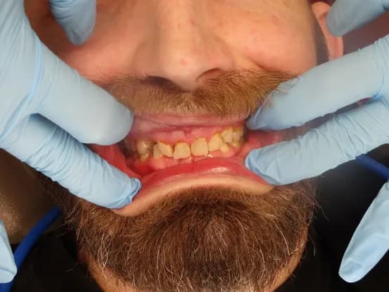 Case 3 Image 3
