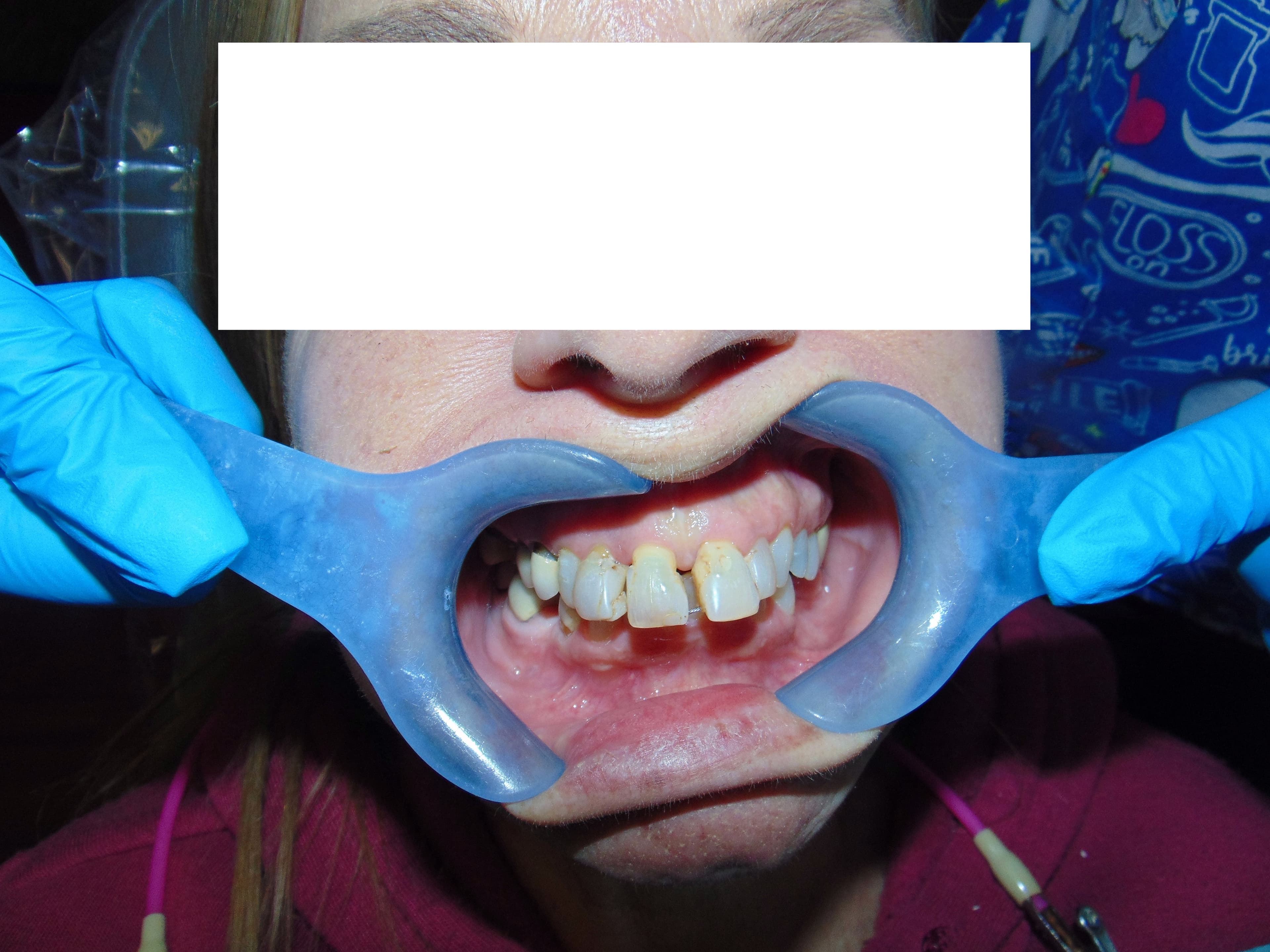Case 12 Image 3