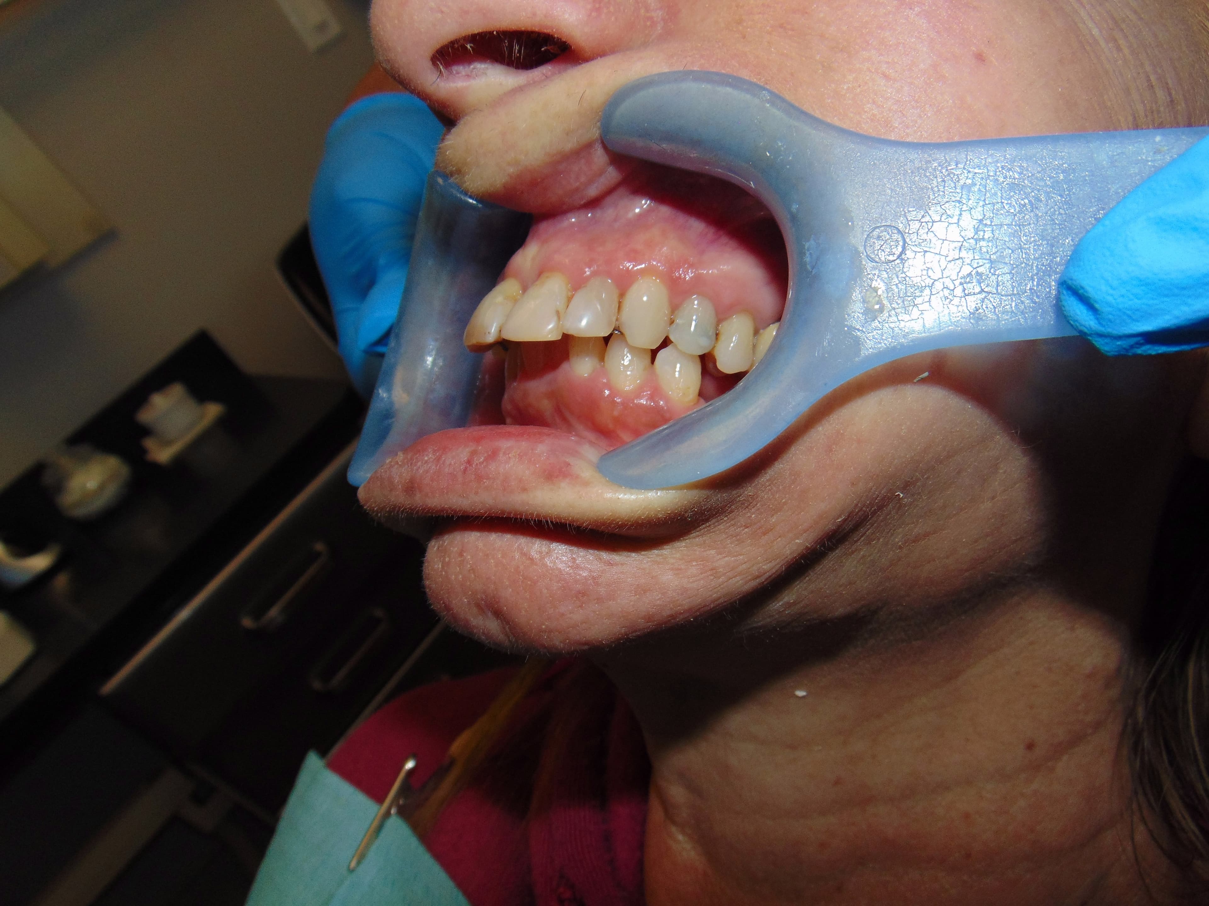 Case 12 Image 4