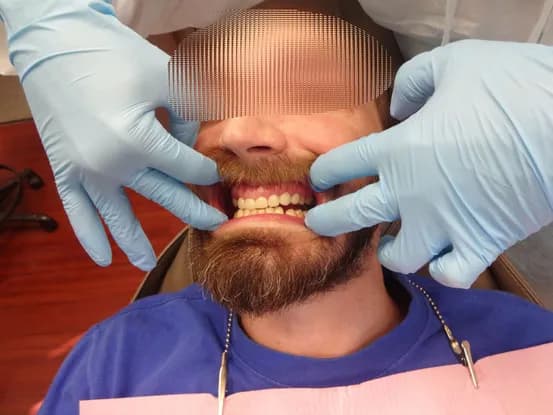 Case 3 Image 5
