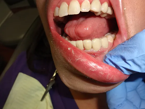 Case 7 Image 7