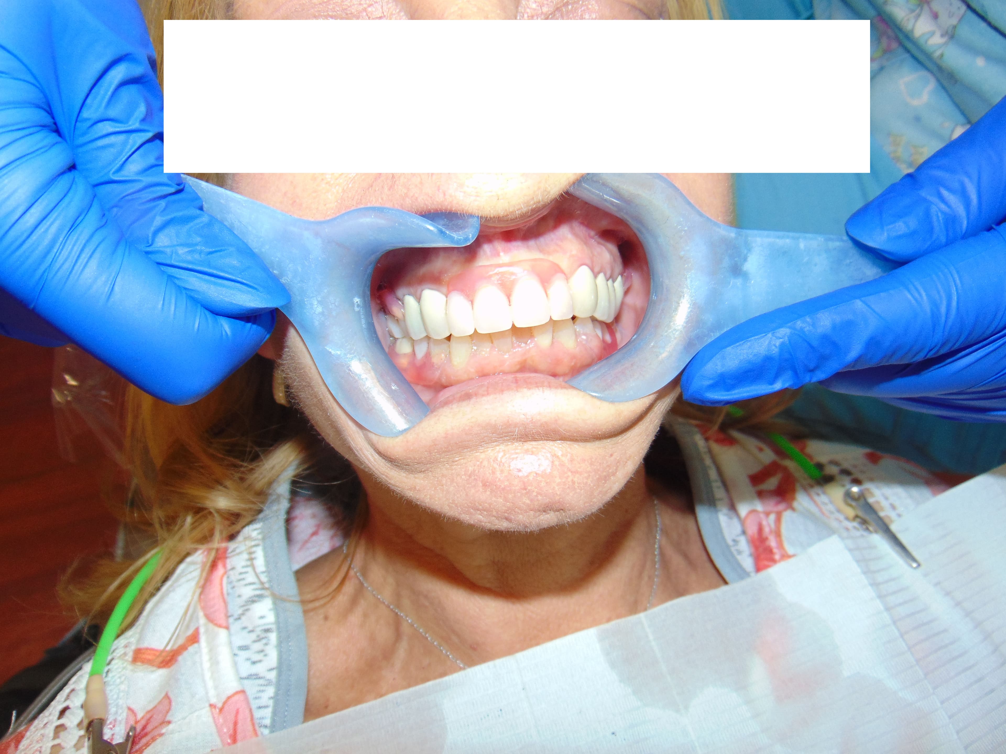 Case 12 Image 9